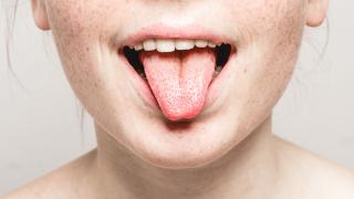 Frau nach der Benutzung von Propolis Mundgel