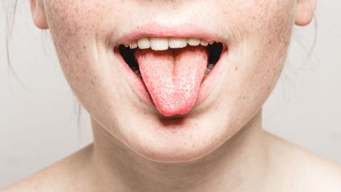 Frau nach der Benutzung von Propolis Mundgel